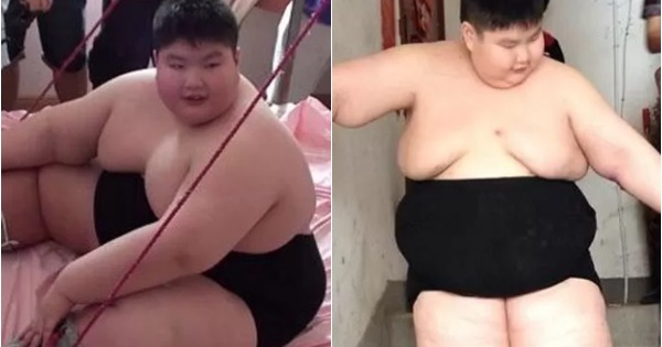 14 tuổi nặng 180kg, cậu nhóc ăn gấp 7 lần người bình thường, phụ huynh phải lên YouTube cầu viện “cứu trợ”