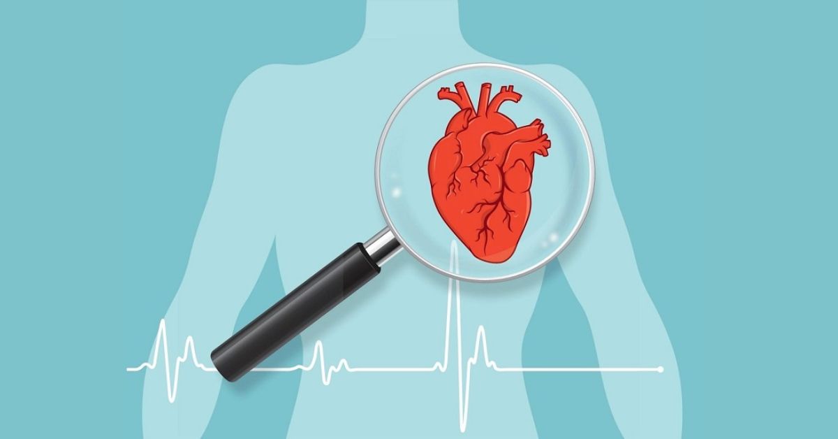 ECG là gì? Dùng để làm gì? Có trên các thiết bị nào?