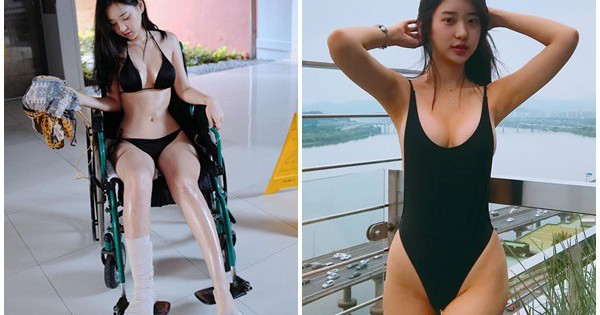 Bó bột, ngồi xe lăn nhưng vẫn mặc bikini gợi cảm, hot girl nóng bỏng khiến cả bệnh viện dậy sóng